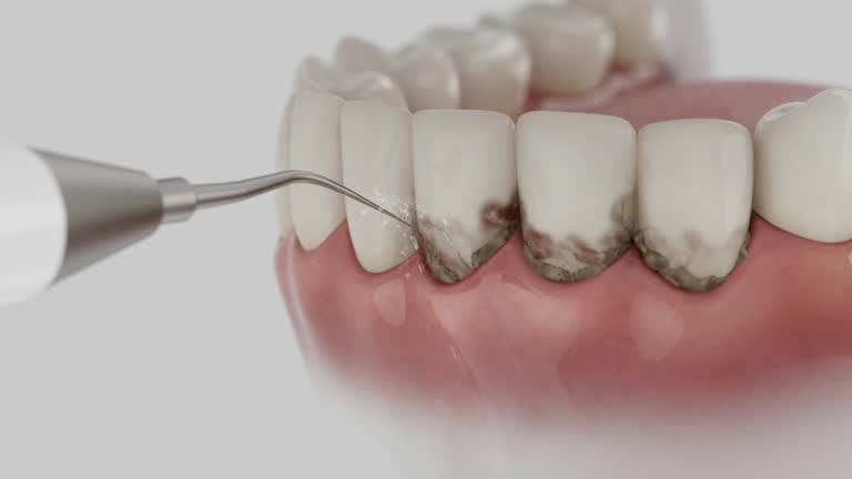 Reliable Dental contractor in New Fairview, TX by Smile Center Dentistry